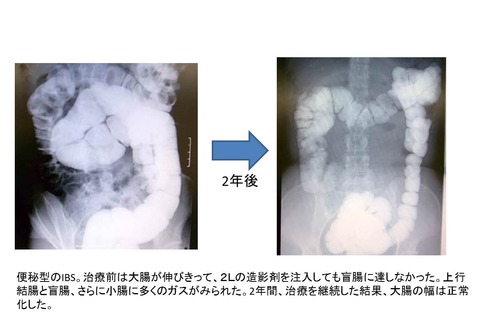 ちりょうご