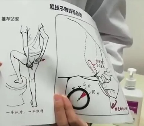 肛門
