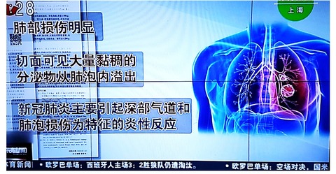 解剖