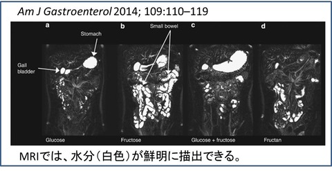 MRI1図1