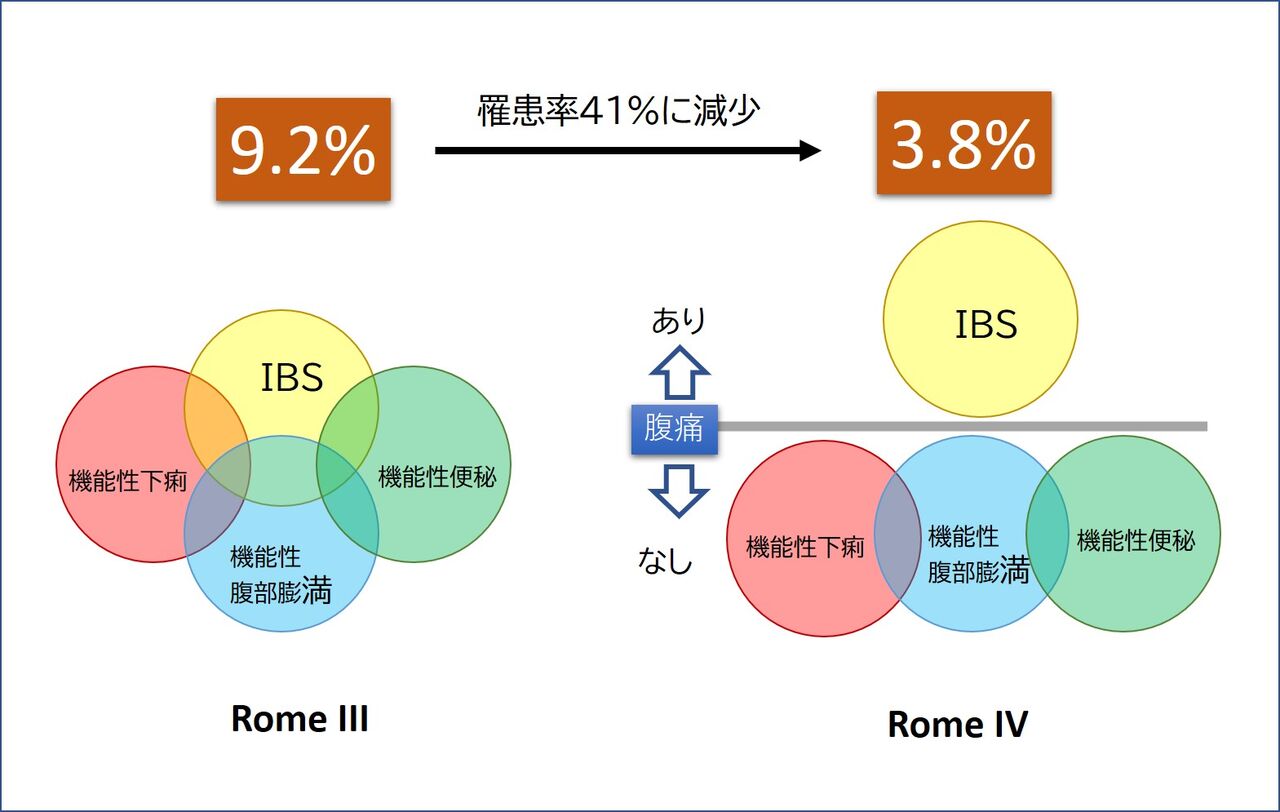Rome Ivで日本のibsが世界一激減した理由 宇野コラム Uno Column