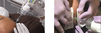 hairfiller2
