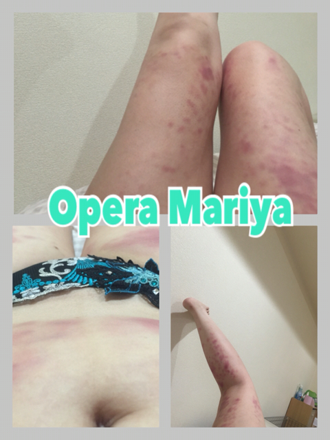 病気っぽいソープ嬢