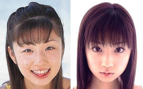 ビフォーアフター17