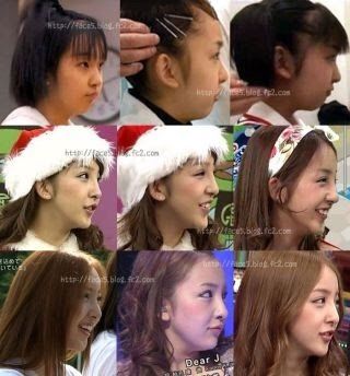 ビフォーアフター5