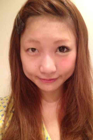 ビフォーアフター25