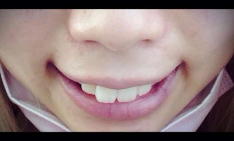 ちいめろ4