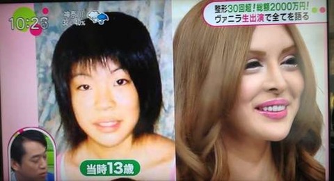 ヴァニラ3