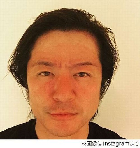 GLAY・TERU2