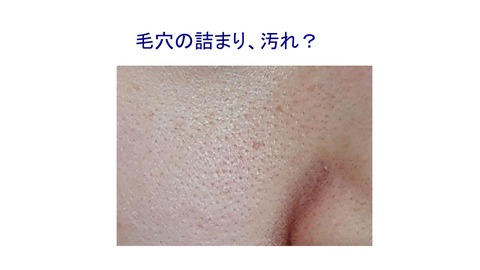 毛穴アップ