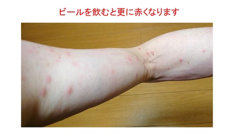 更に赤く