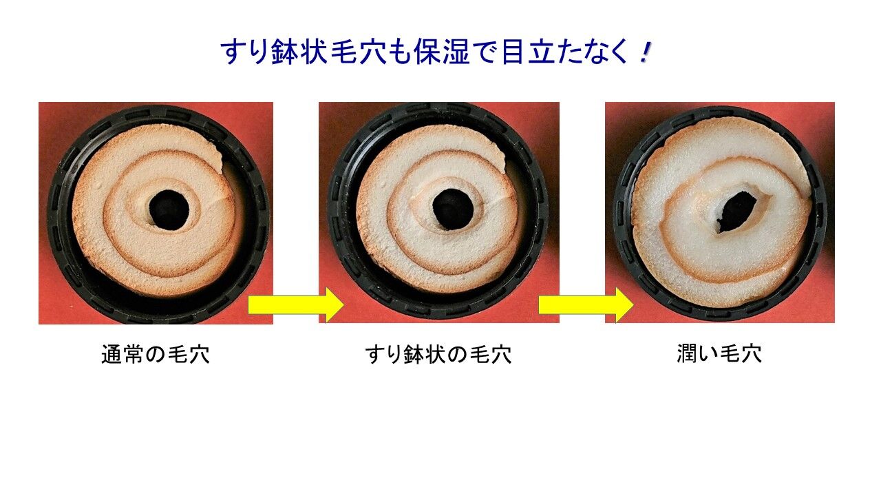 毛穴に落ちた有識者ども アナトミー村本の若肌研究所 Wakahada Research