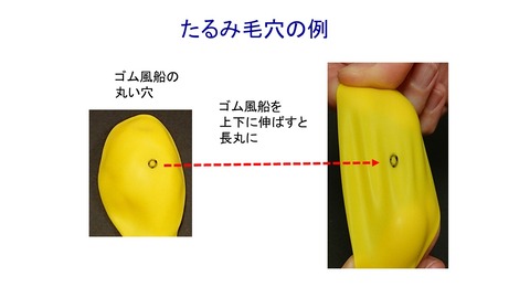 たるみ毛穴の例