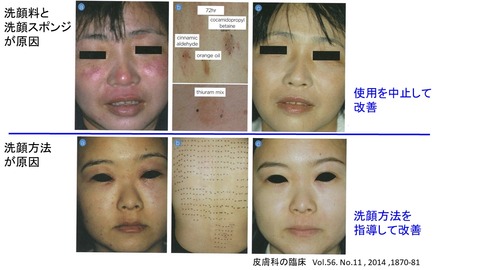 洗顔刺激