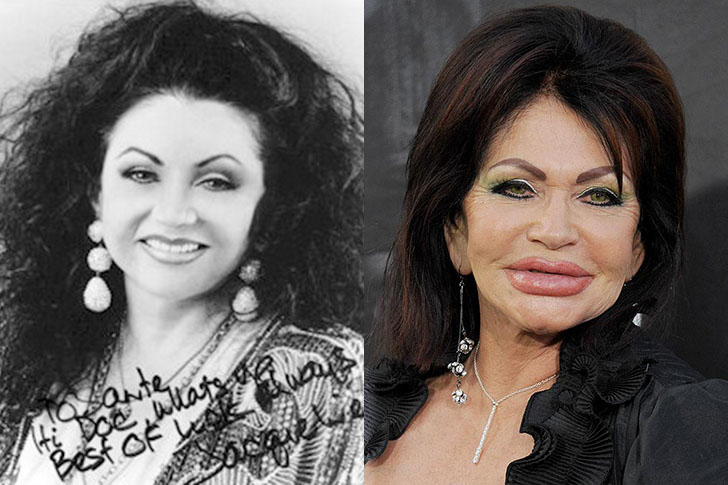 画像あり 整形に失敗したセレブたち ニュースシルクロード