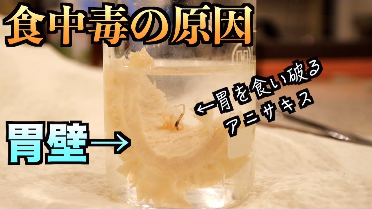 トミック 寄生虫 アニサキス がどうやって胃を食い破って暴れてるかわかる動画 Youtuberコメ速報