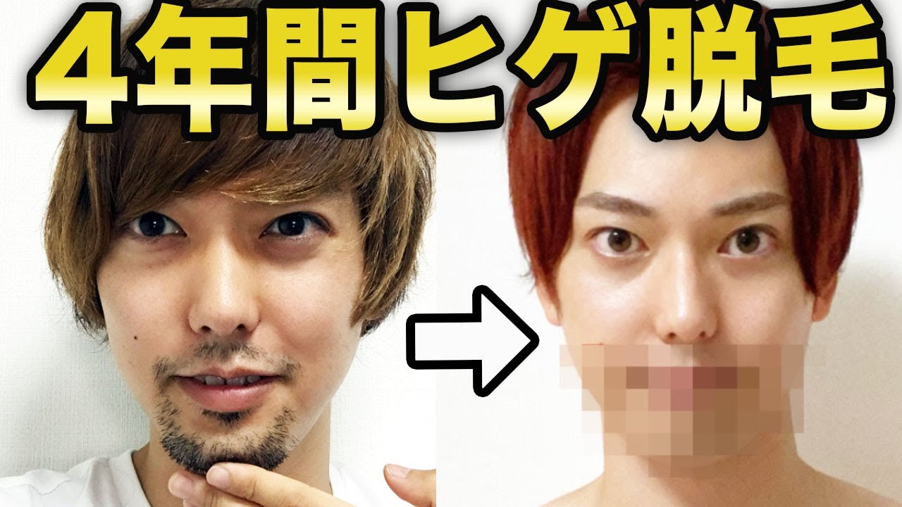 おるたなチャンネル 4年間ヒゲ永久脱毛した男が1週間ヒゲを伸ばしたらどうなる Youtuberコメ速報 おるたなチャンネル 4年間ヒゲ永久脱毛した男が1週間ヒゲを伸ばしたらどうなる Youtuberコメ速報