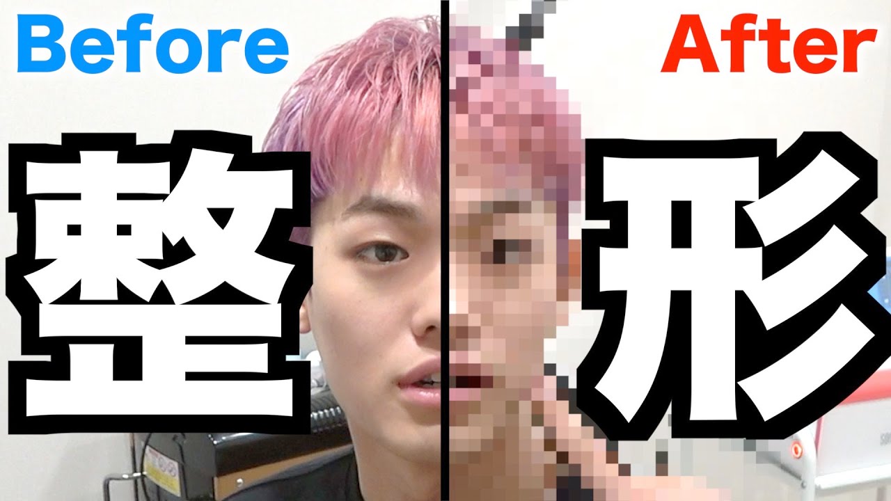 禁断ボーイズ 男ですが 整形しました Youtuberコメ速報
