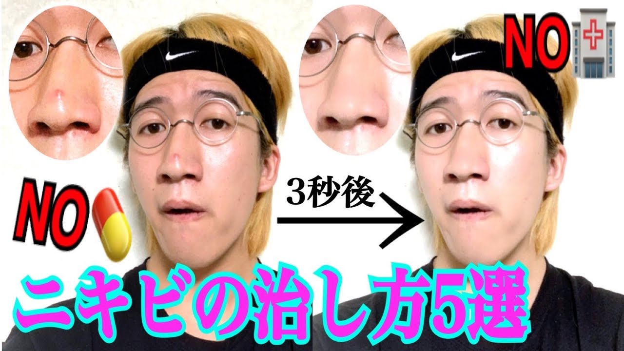 チョコレートスモーカーズ ジョンレノがニキビの治し方5選を教えます Youtuberコメ速報 チョコレートスモーカーズ ジョンレノがニキビの治し方5選を教えます Youtuberコメ速報