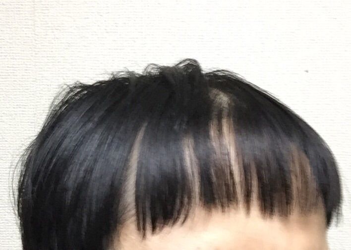 悲報 セルフカットした俺薄毛24歳の前髪 2ちゃんアンカー 悲報 セルフカットした俺薄毛24歳の前髪 2ちゃんアンカー