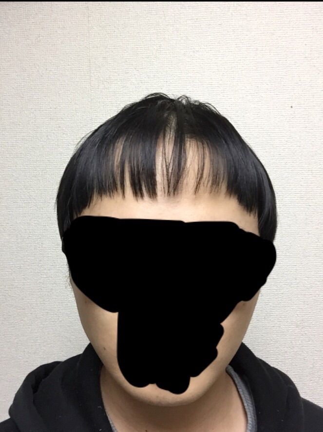 悲報 セルフカットした俺薄毛24歳の前髪 2ちゃんアンカー 悲報 セルフカットした俺薄毛24歳の前髪 2ちゃんアンカー
