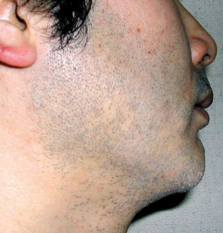 頬からもヒゲ生える奴wwwwwwww ハロー速報