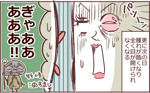 166