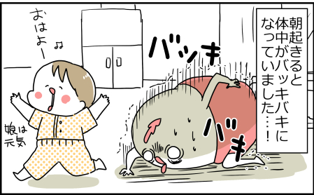 110