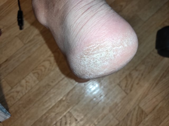 かかとがぱっくり Turaco 旅と日常を綴る かかとがぱっくり Turaco 旅と日常を綴る