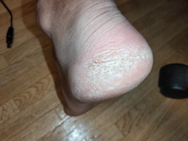 かかとがぱっくり Turaco 旅と日常を綴る かかとがぱっくり Turaco 旅と日常を綴る