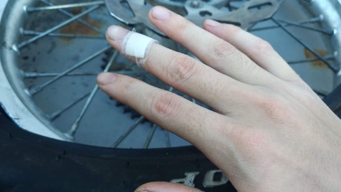 力任せにタイヤ交換をしたら怪我をした写真