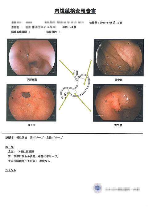 2015-08-17　胃カメラ_ページ_2