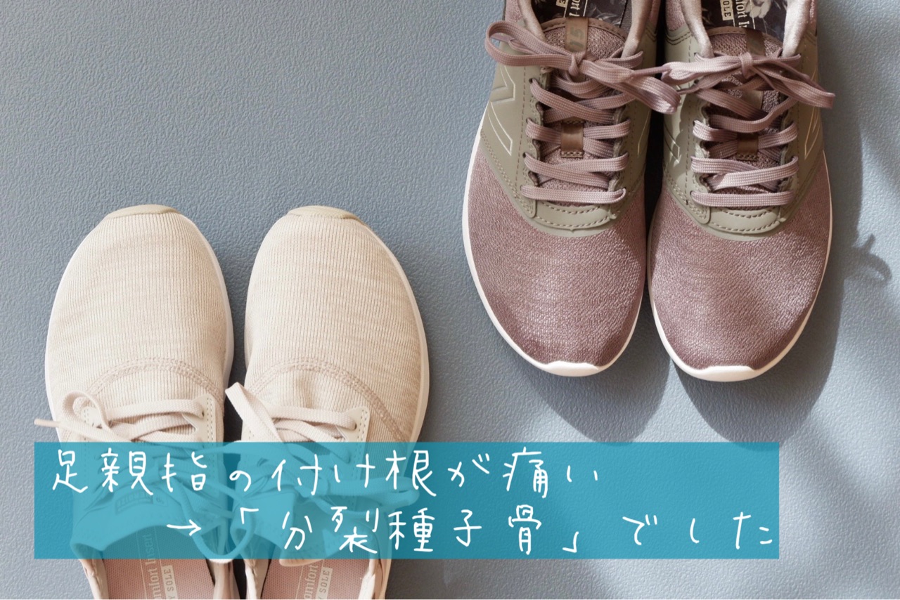足親指の付け根が痛い 分裂種子骨 でした ゆとりあるシンプルな暮らし Powered By ライブドアブログ