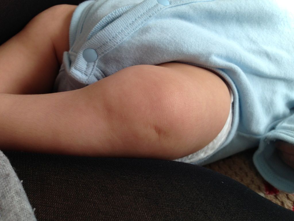 膝のえくぼ １１２５