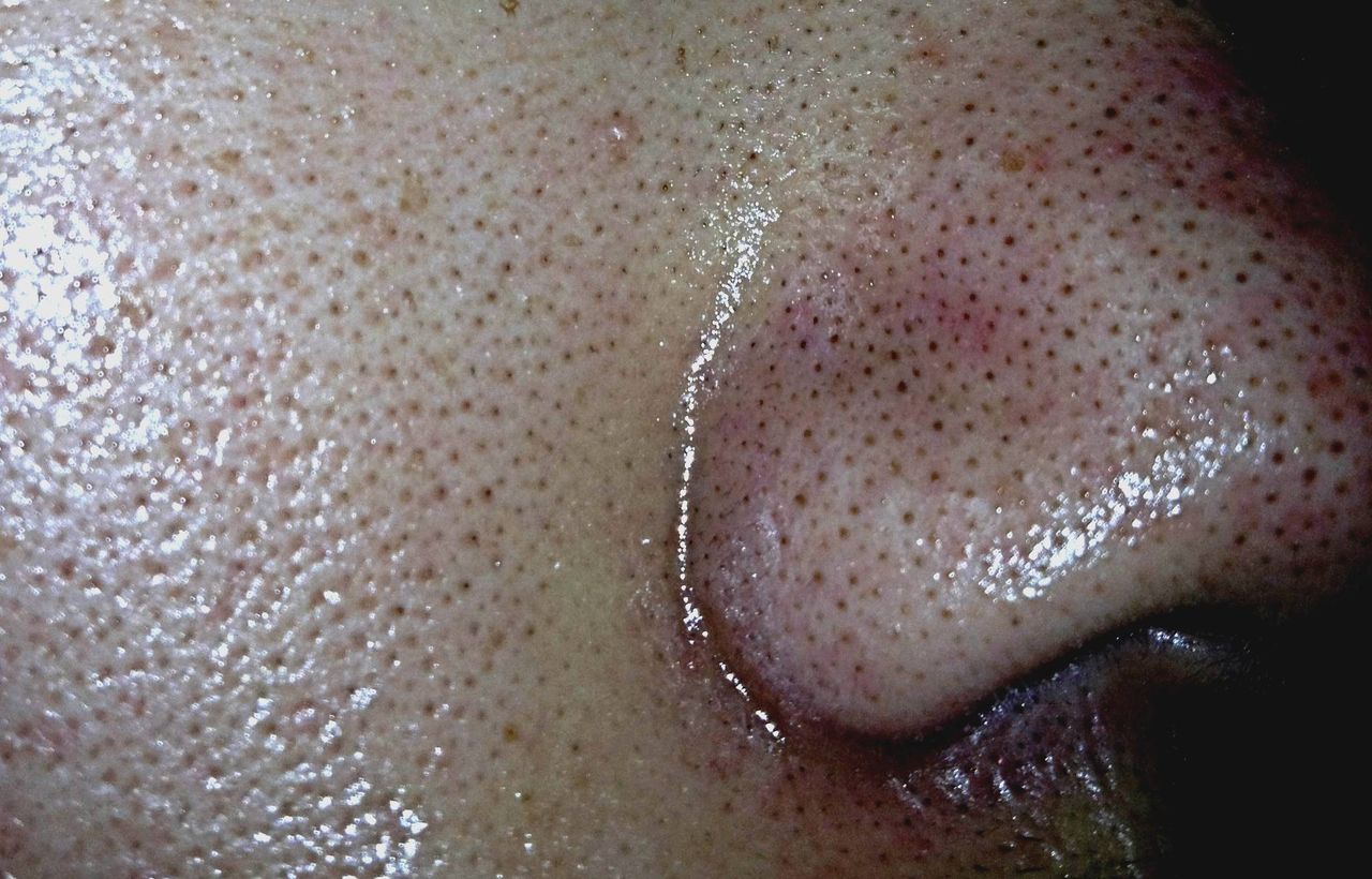 グロ注意 俺の鼻汚すぎワロタwwwwwwwwwwww 2ch きゅんきゅんなvip