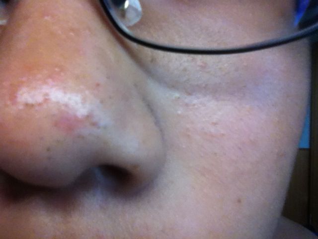 グロ注意 俺の鼻汚すぎワロタwwwwwwwwwwww 2ch きゅんきゅんなvip