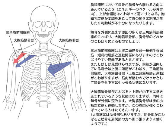 胸鎖関節において鎖骨が外側方へ歪む原因2