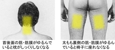筋筋膜の変調