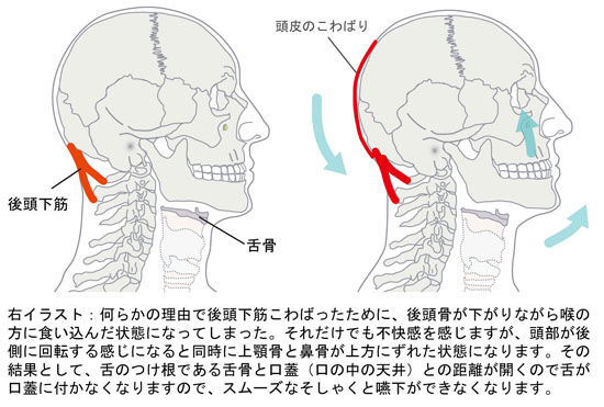 後頭下筋の「こ」によって舌が上がらない