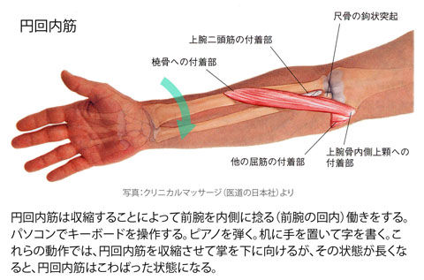 円回内筋のこわばり