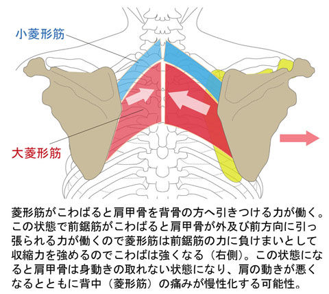 菱形筋と前鋸筋の「こ」による背中の痛み