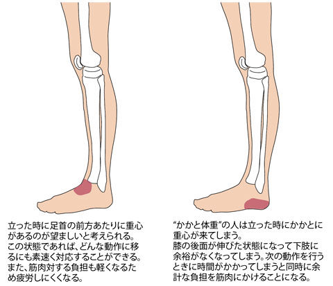 かかと重心 を改善しましょう ゆめとわのblog