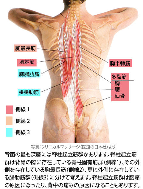 脊柱起立筋群と背中の痛み