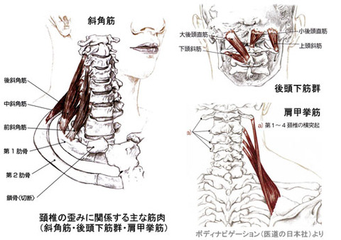 頚椎の歪みに関係する主な筋肉