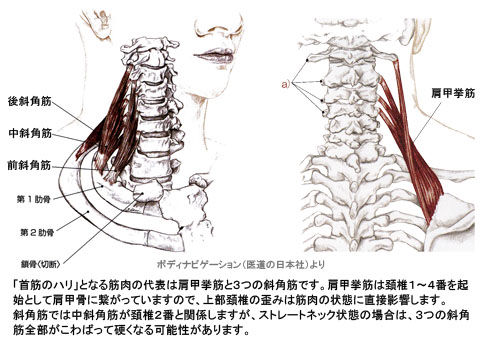ストレートネックと首筋の硬さ