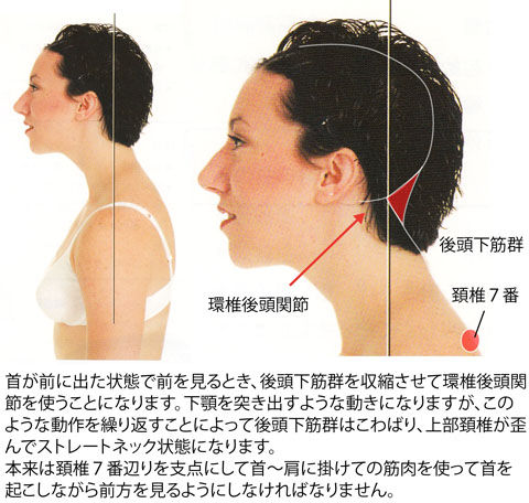 後頭下筋群を使って前を見る動作