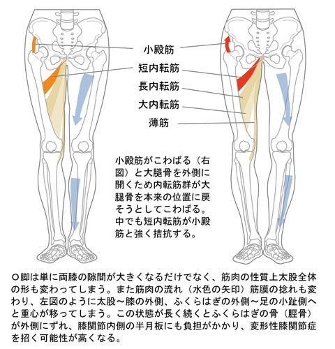 Ｏ脚と下肢の筋肉・骨格02