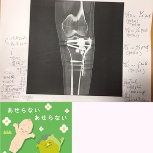 2017-01-31-12-58-32