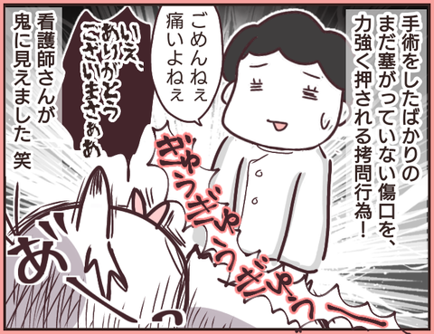 帝王切開4