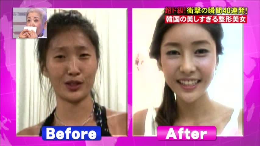 美人妻が産んだ子がブサイクすぎ 夫は浮気を疑いdna鑑定を依頼 妻は整形美女だった 三十路オトコの加齢なる日常